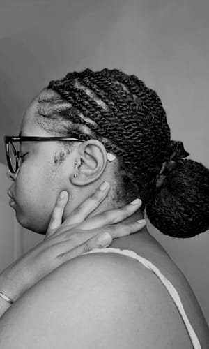 Customer photo review of Minoxidil5% Solution, 1 Pack 60ml