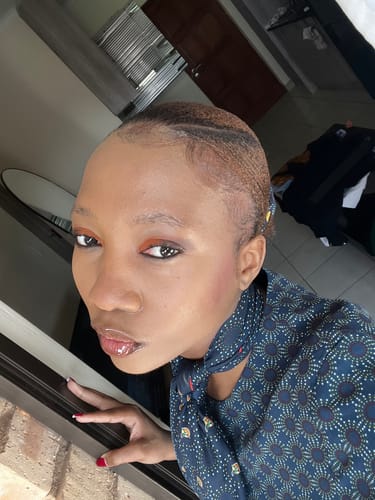 Customer photo review of Minoxidil 5% FOAM, 3x60ml pack