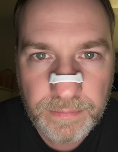 Customer photo review of Flow - Magneettiset Nenänauhat