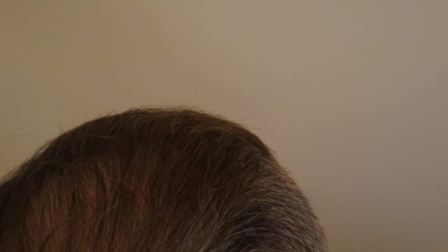 Customer photo review of GR-7 PRO