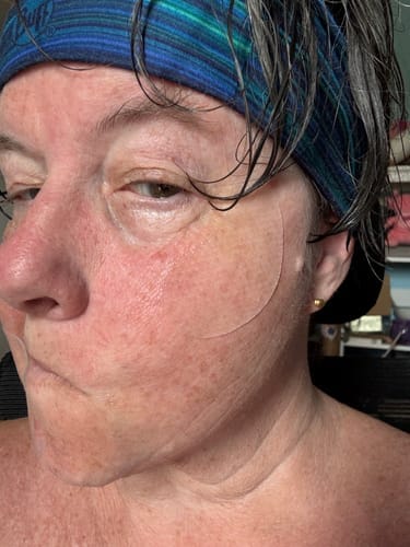 Customer photo review of Collagen eye patch Jericho rose jelly