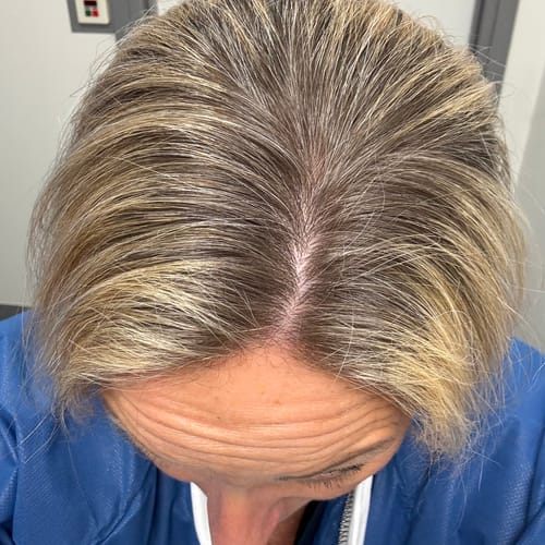 Customer's hair before using the Sunkissed Refill, showing dark roots and existing blonde highlights.