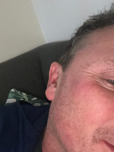 Customer photo review of Seb Natural Calming Serum