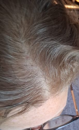 Close-up of a reviewer's scalp showing blended grey and brown hair after using the Grey Cover.