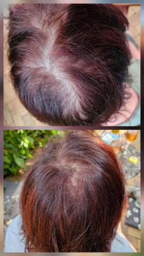 Customer photo review of Hair & Nail Capsules