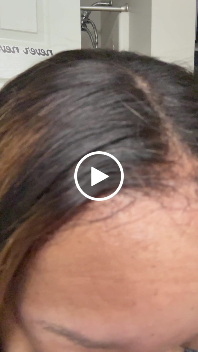Customer video review of The Complete All in One Wig Install Kit