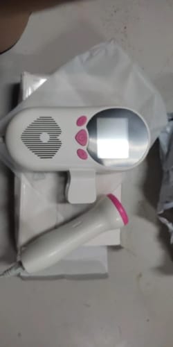 Customer photo review of Fetal Doppler™ Baby Heart Monitor