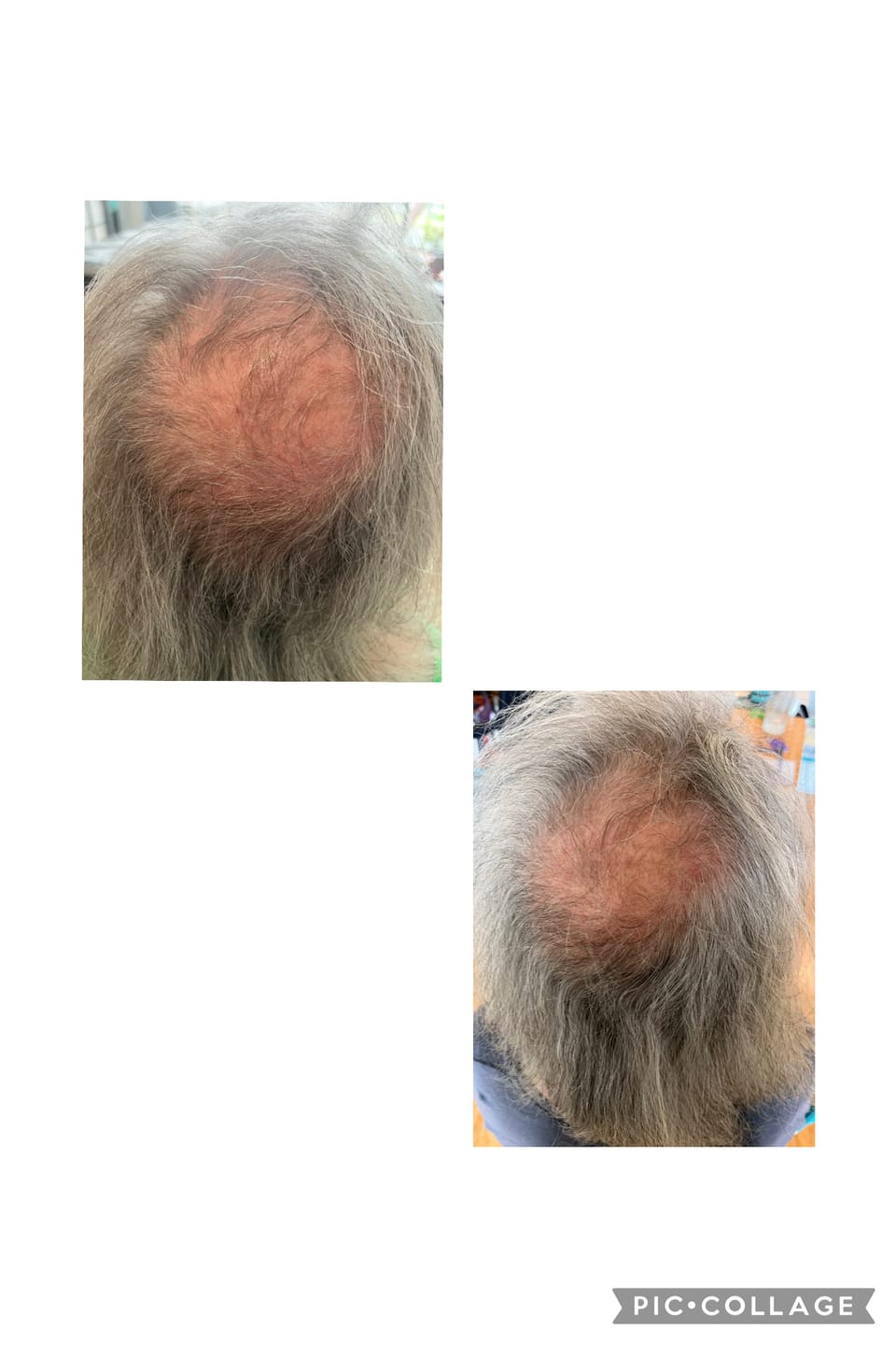 Customer photo review of PEPTIDE-POWERED HAIR SERUM