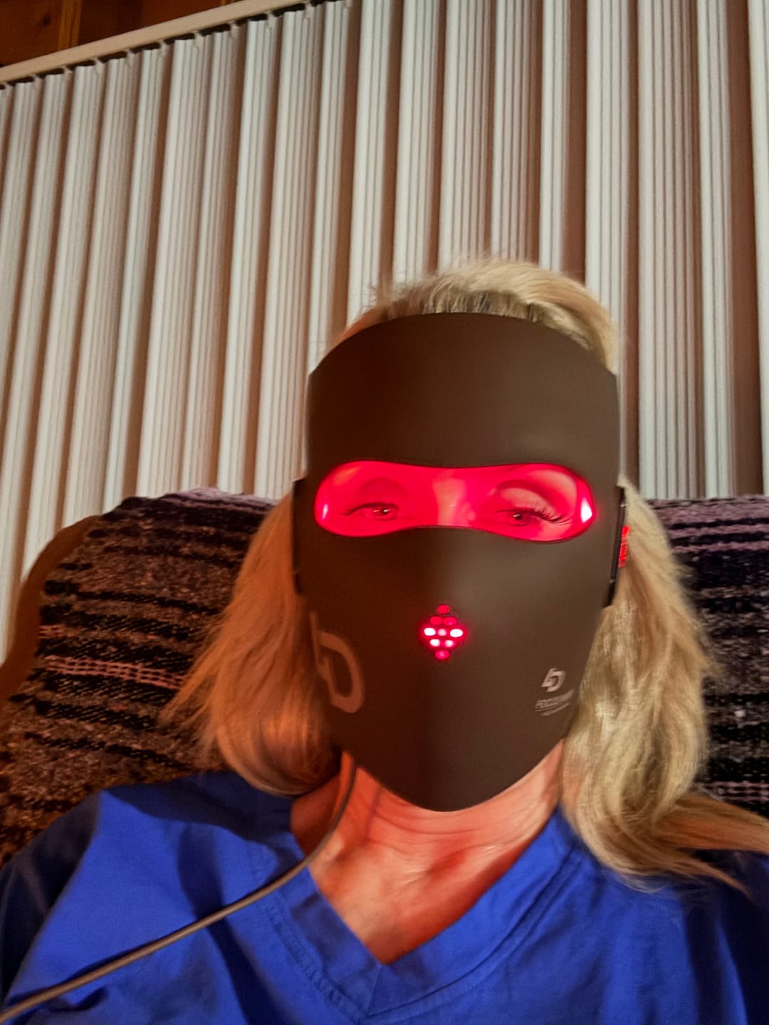 Customer photo review of JOVS 4D Laser Light Therapy Mask