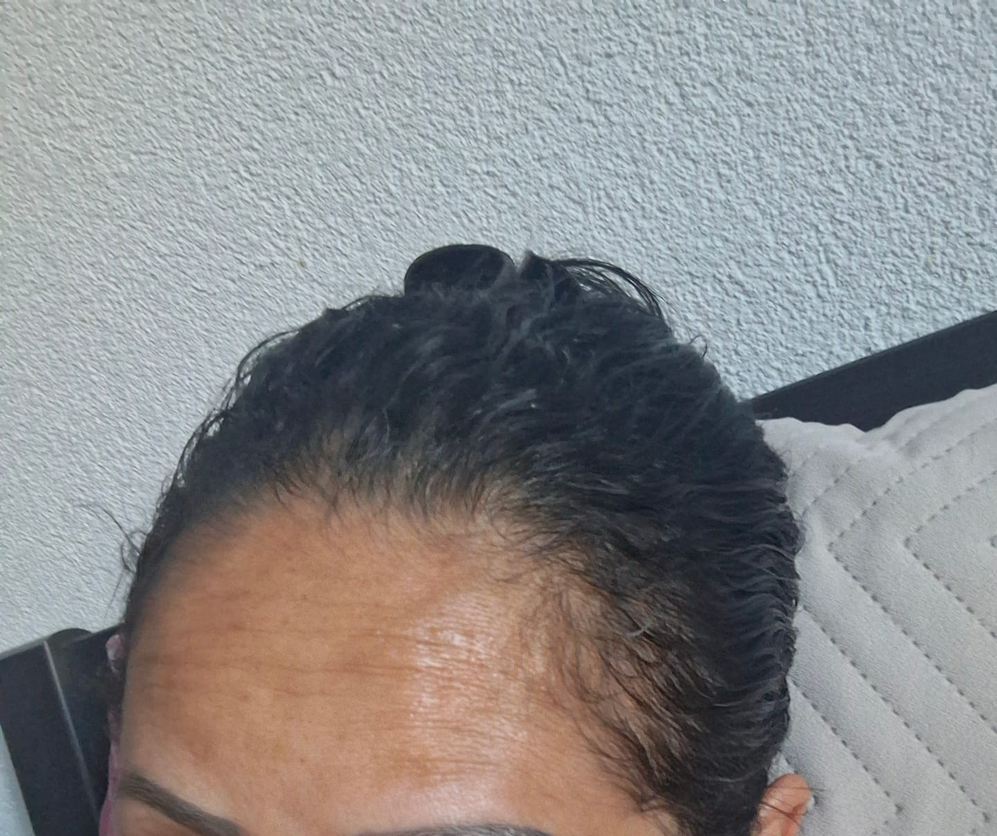 Customer photo review of Sérum de croissance pour cheveux (3 mois)