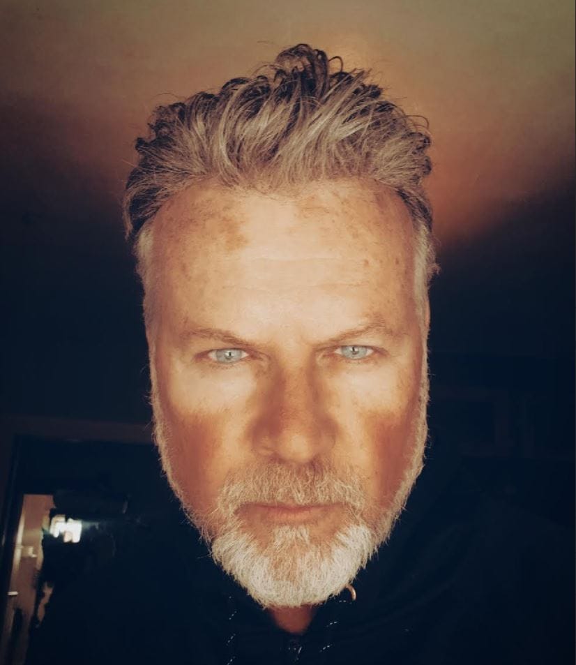 Customer photo review of Clover Blue Prescription Colored Contact Lenses
