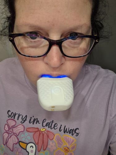 Customer photo review of GlowSmile™ - Smartbrush