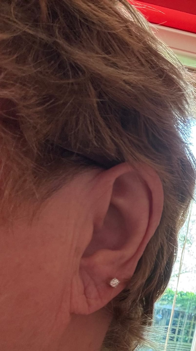 Customer photo review of 9K Gold World's First Lab Grown Diamond Sleep Stud Earrings