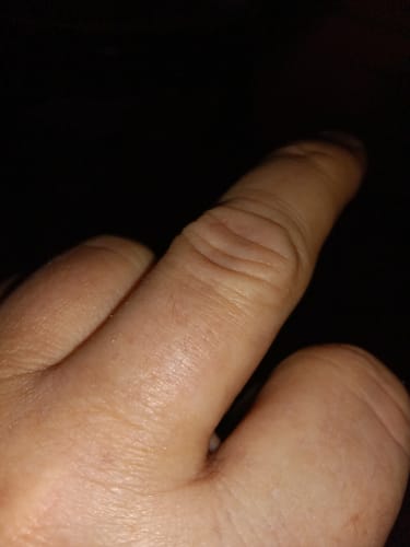 Customer photo review of 🦷  Fit Full Functional DenturesMake you more confident-Made in the USA & FDA-Certified