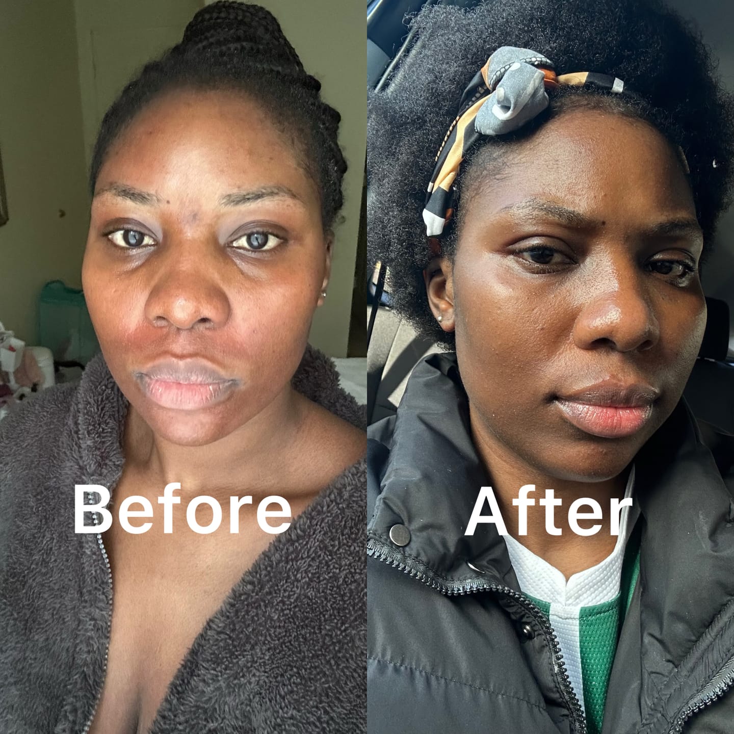 Customer photo review of Nourishing and Brightening Face Cream