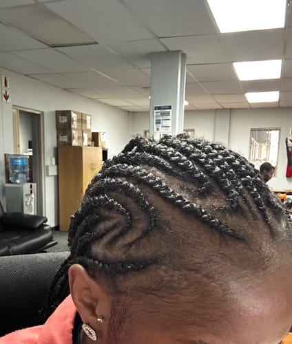 Customer photo review of Minoxidil High Strength (5%) SOLUTION, 3x60ml pack