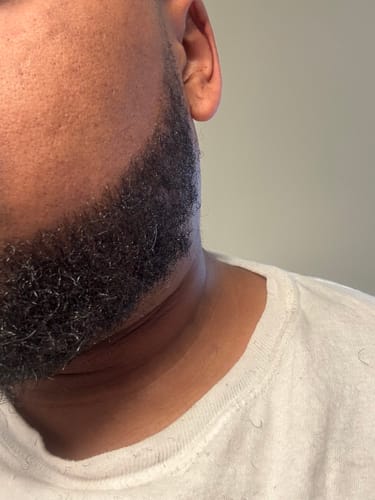Customer photo review of Beard Care Kit