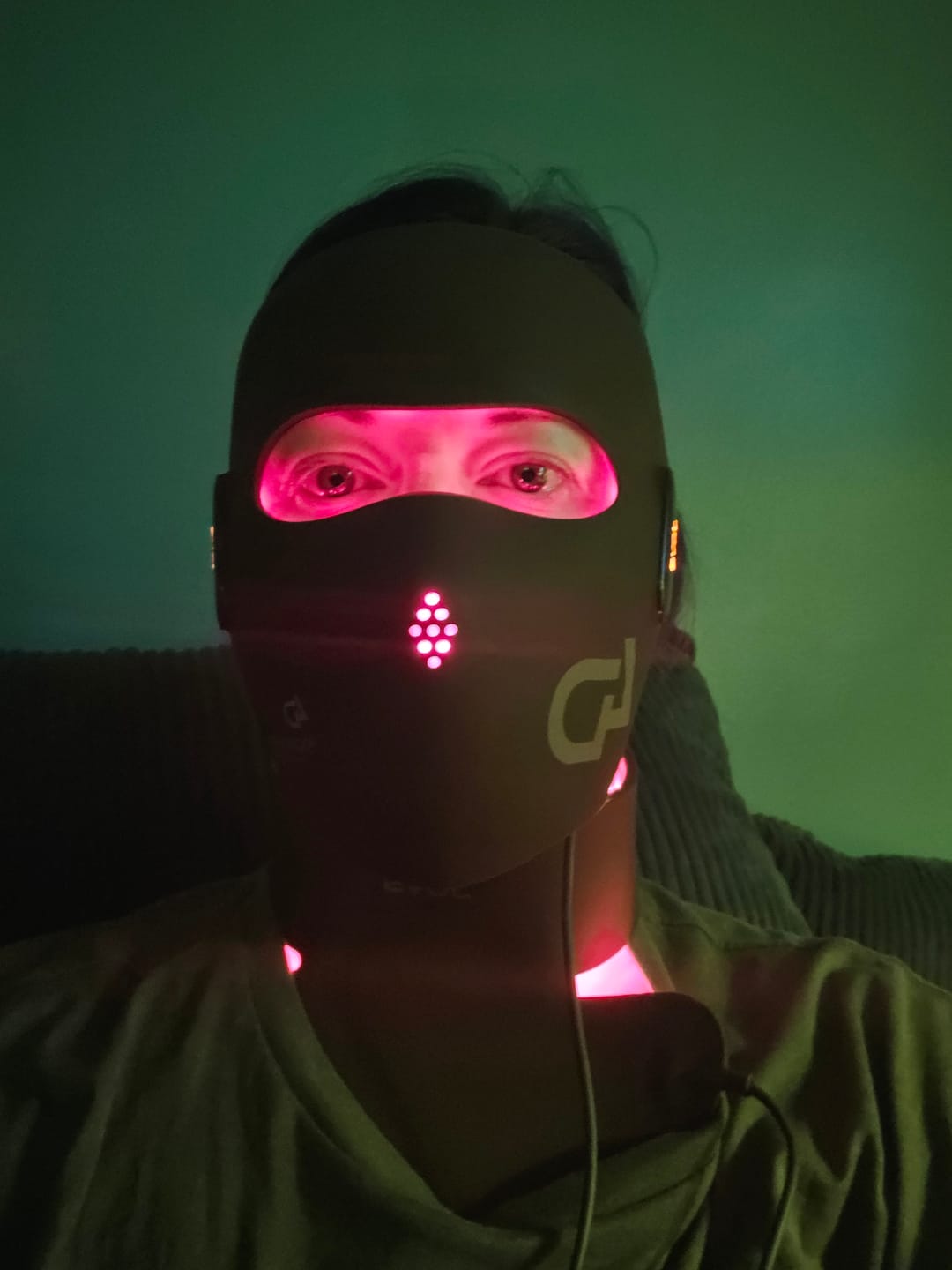 Customer photo review of JOVS 4D Laser Anti-Aging Therapy Mask