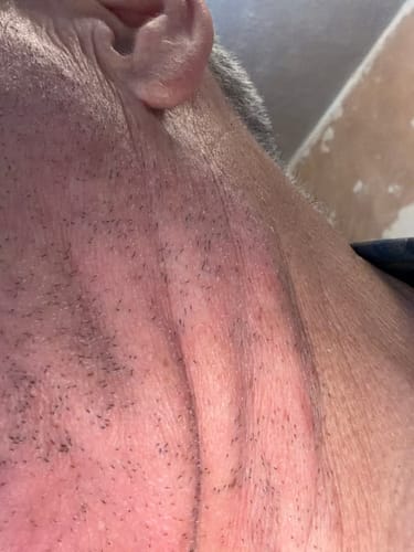 Customer photo review of Seb Natural Calming Serum