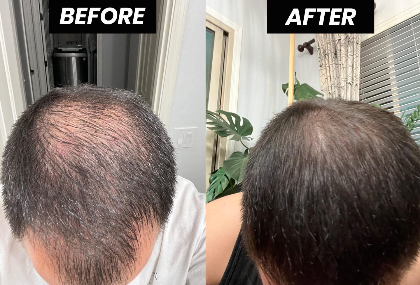 Customer photo review of Dual-Applicator Hair Regrowth System