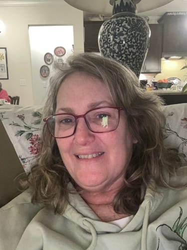 Customer photo review of TryTallow™ Grass-Fed Tallow Balm (4oz)