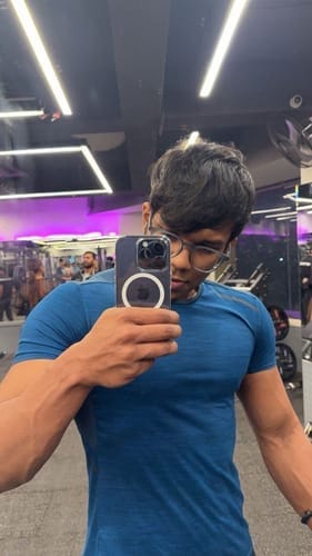 Customer photo review of Anti-Yellow Clear Case - Redmi Note 13 5G