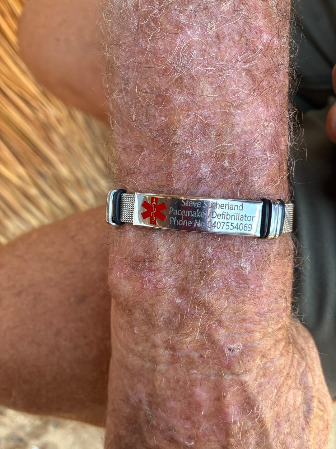 Customer photo review of Personalised Silver Steel Medical Alert ID Mesh Bracelet