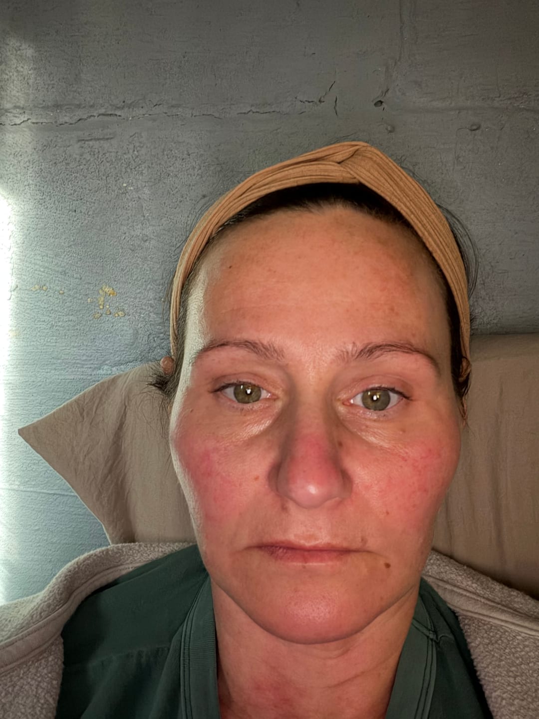 Customer photo review of JOVS 4D Laser Light Therapy Mask