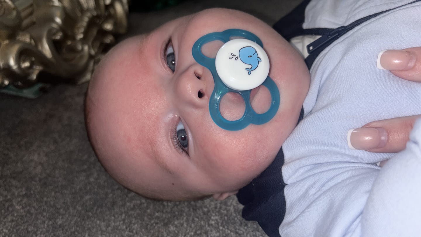 Customer photo review of Bioskin Junior Outbreak Rescue Cream