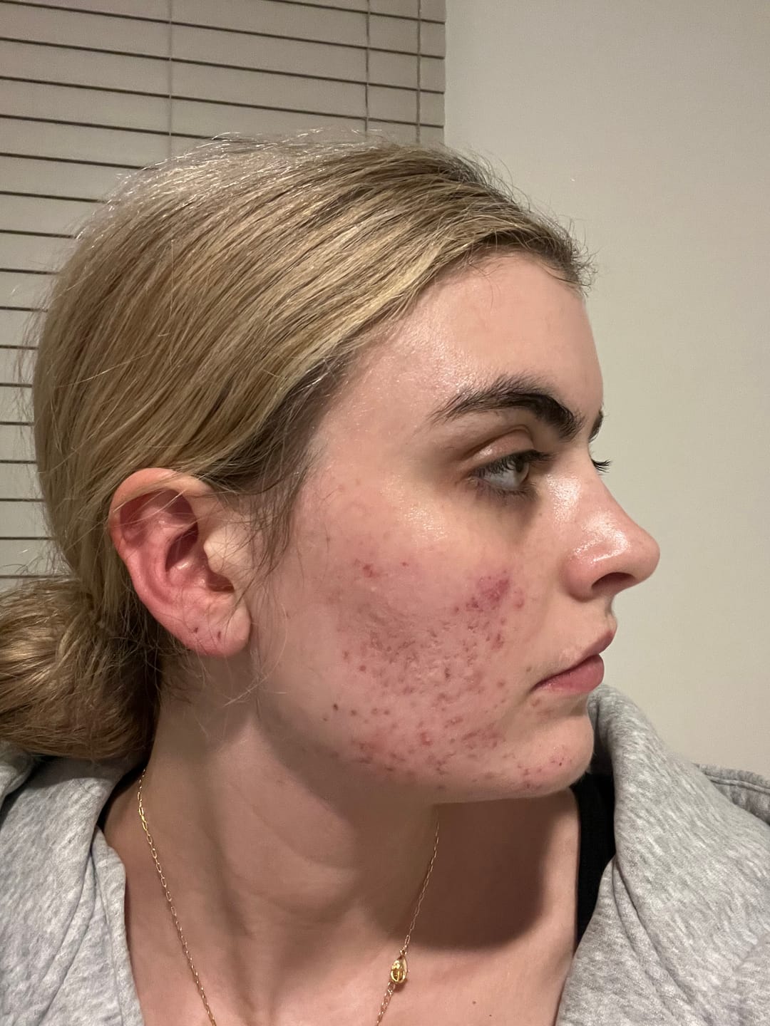 Customer photo review of clear balance trio | microbiome smart system
