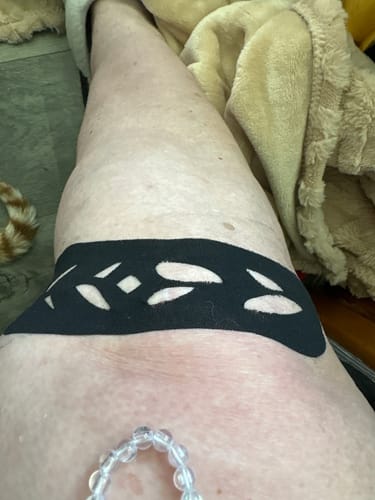 Customer photo review of Easy Kinesiology Tape (30-Day Supply)