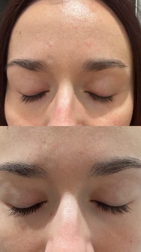 Customer photo review of KosmaLash® | Sérum Crecimiento & Anticaída