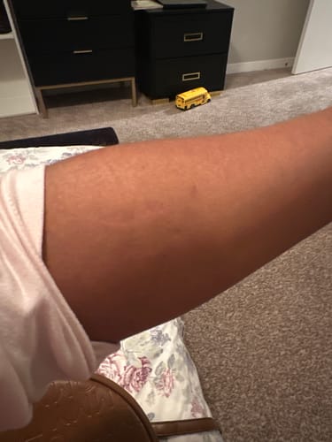 Customer photo review of Fair and White Exclusive Body Lotion with Pure Vitamin "C" 500ml 16.9 fl oz