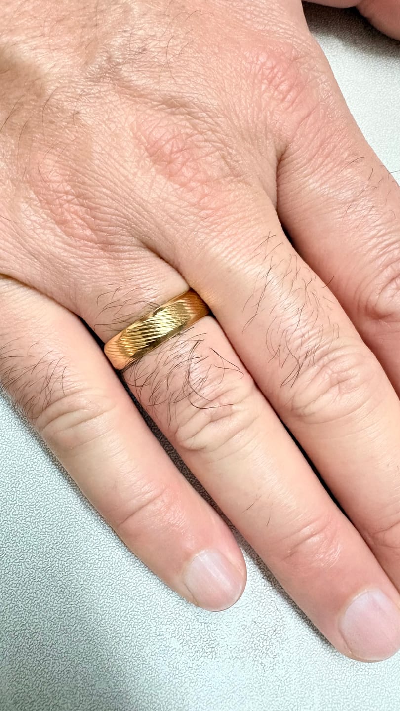Customer photo review of Dune Line Textured Ring