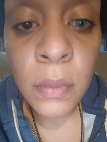 Reviewer's close-up showing a vibrant Hidrocor TOPAZIO lens on one eye, compared to their natural dark brown eye.