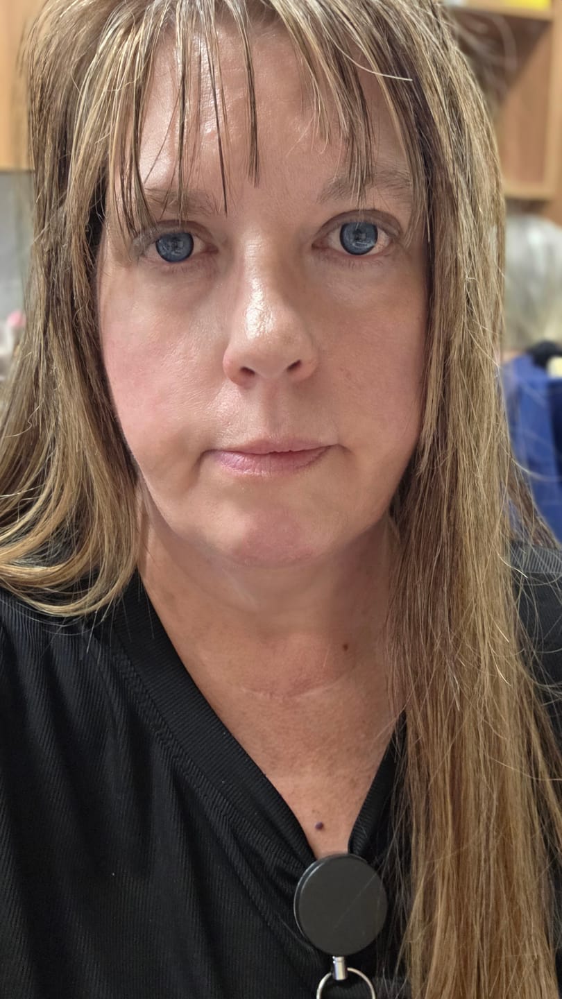 Customer photo review of Norko Blue Prescription Colored Contact Lenses