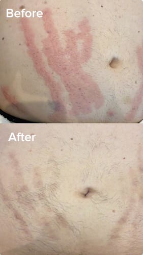 Customer photo review of Nova Glow – Nourishing Body Oil