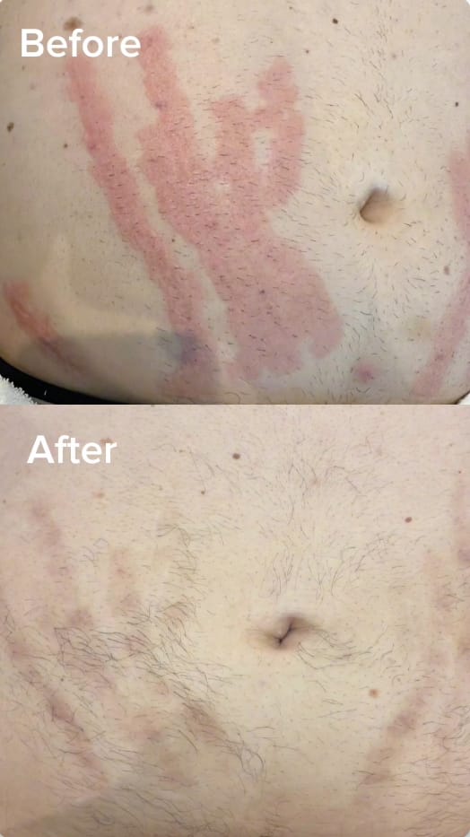 Customer photo review of Nova Glow – Nourishing Body Oil