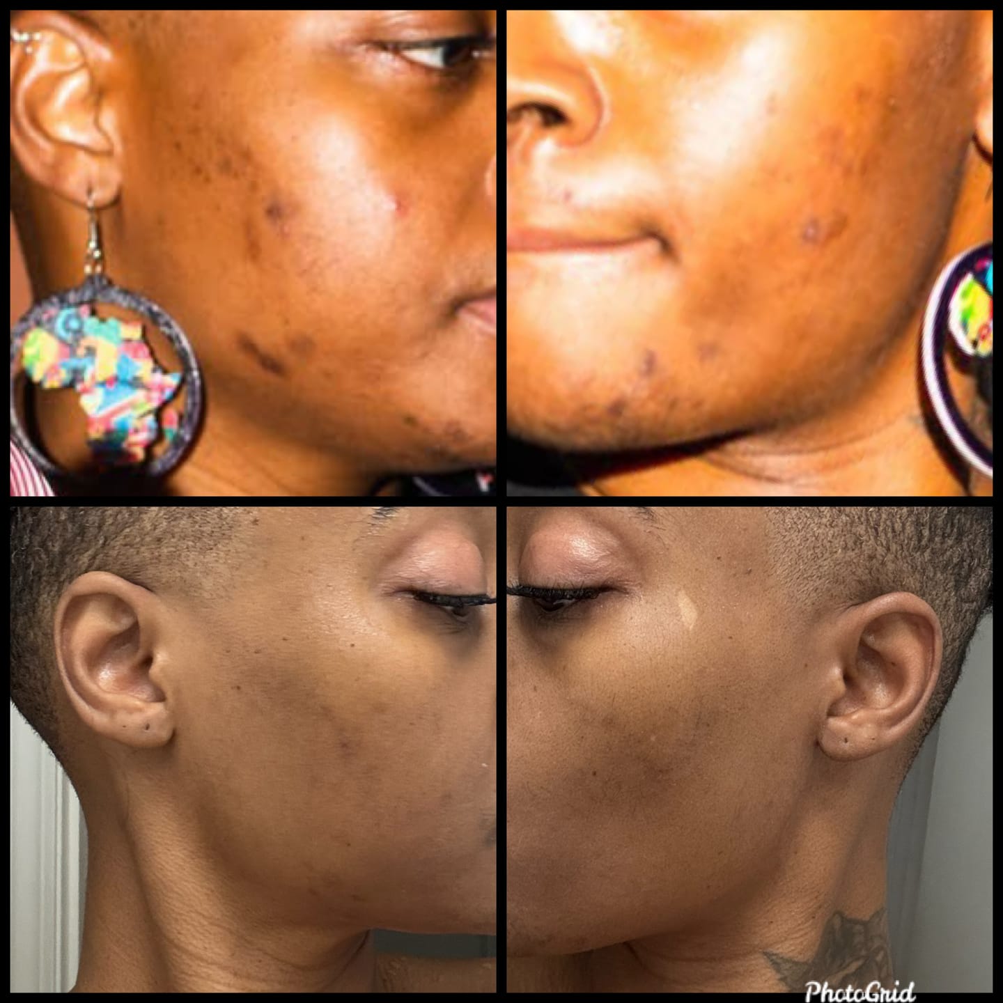 Customer photo review of Glass Skin Face Kit
