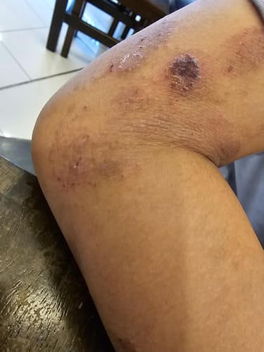 Customer photo review of Jolicare Cream