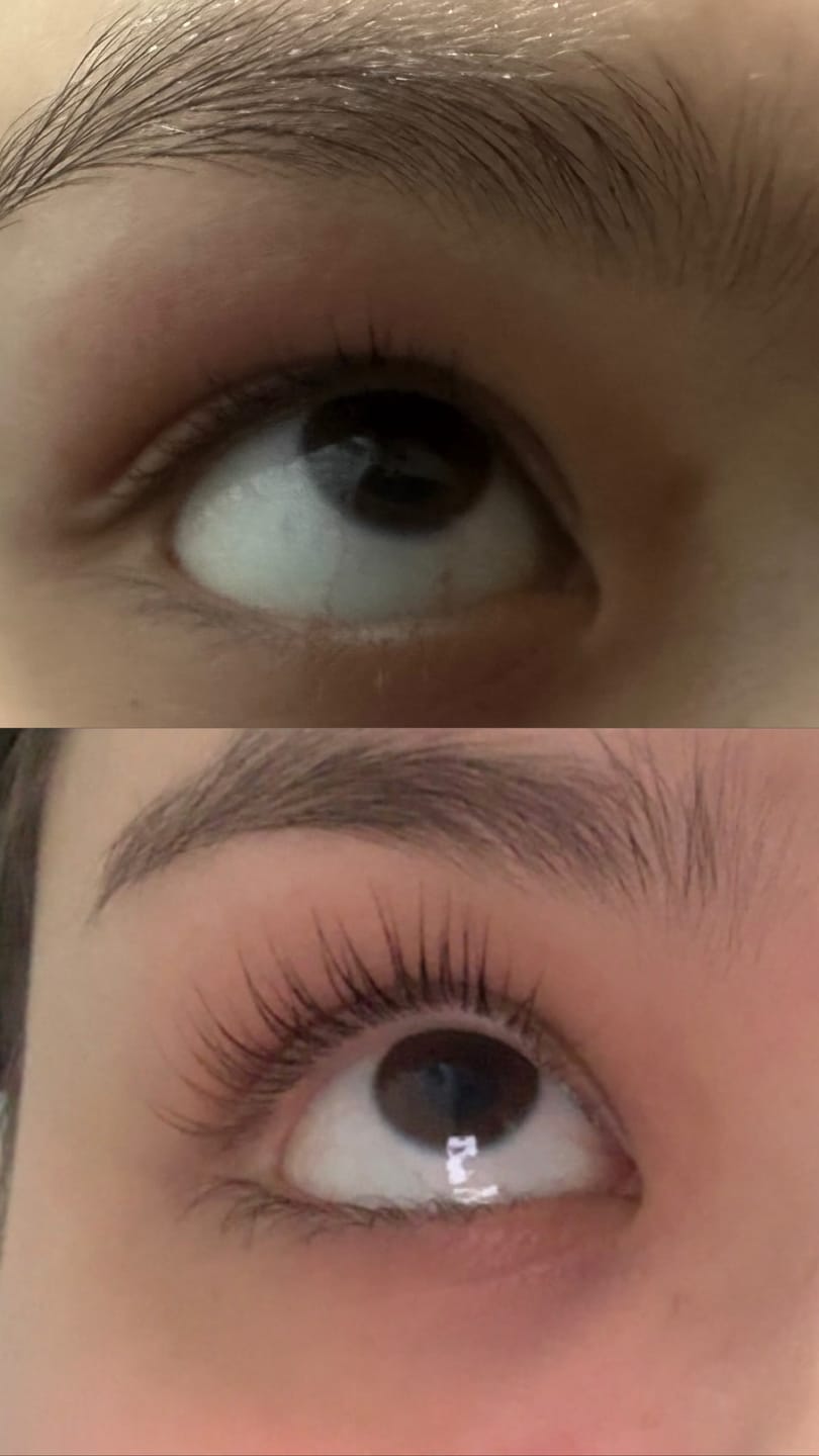 Customer photo review of WIMPERNSERUM