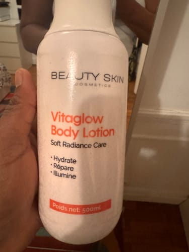 Customer photo review of VITAGLOW BODY LOTION- SOFT RADIANCE CARE