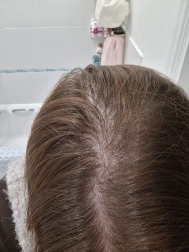 Customer photo review of The 3X Growth Kit™