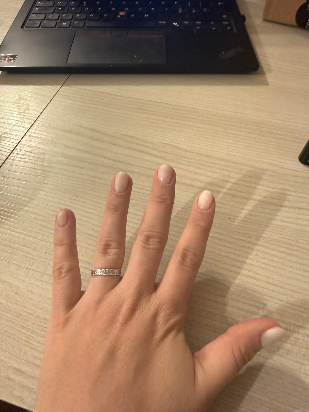 Customer photo review of LCI Combo Pack: Base Coat 10 ml + Top Coat 10 ml