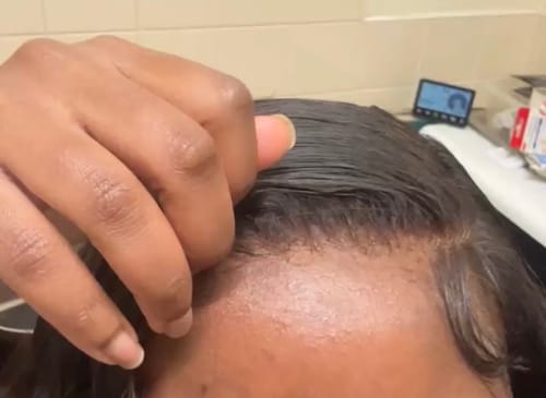 Customer photo review of Hold Me Down Lace Glue