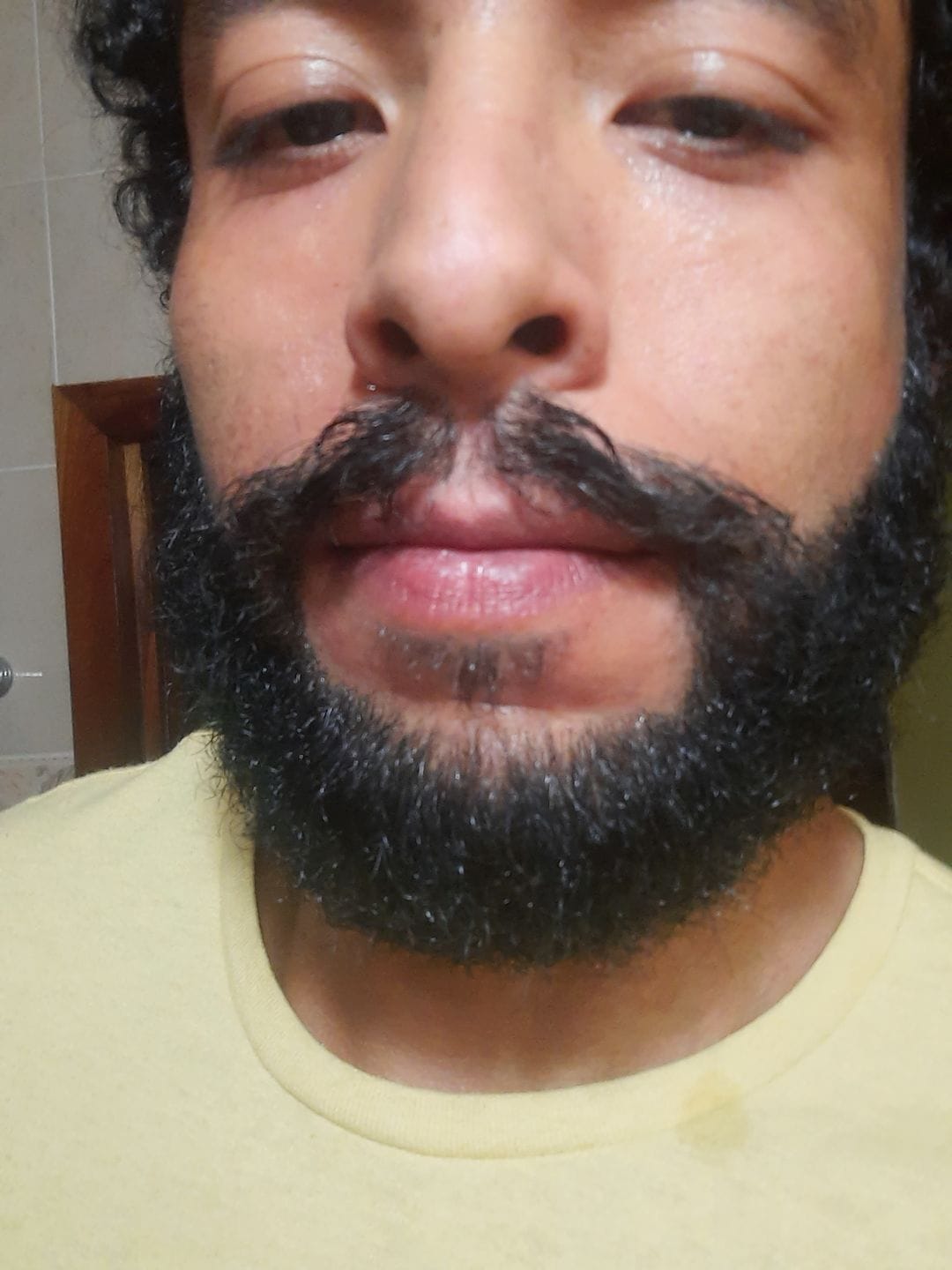 Customer photo review of Aceite Natural Hidratante | Barba-Cabello-Piel- Pre y Post Afeitado