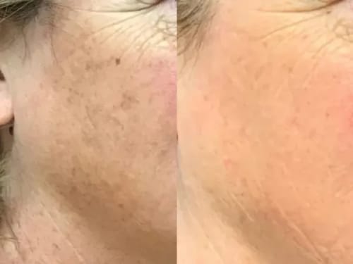 Customer photo review of Labbok Peptides Skin Lightening Combo Box