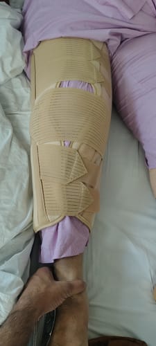 Customer photo review of Knee Brace - Long (19" Brace) | Ideal firm Knee support that limits knee motion & stabilizes the knee with mediolateral metal supports | Color - Beige
