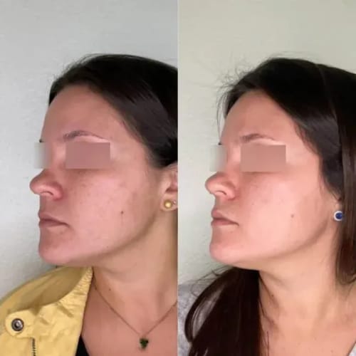 Customer photo review of Labbok Peptides Skin Lightening Combo Box