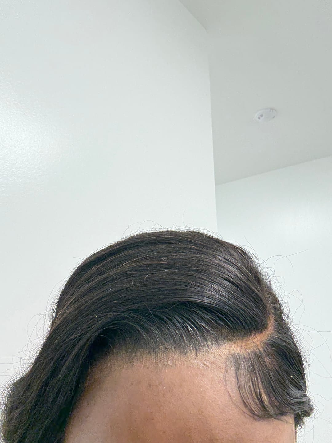 Customer photo review of Hold Me Down™ Adhesive Skin Guard (Ain’t No Other™)